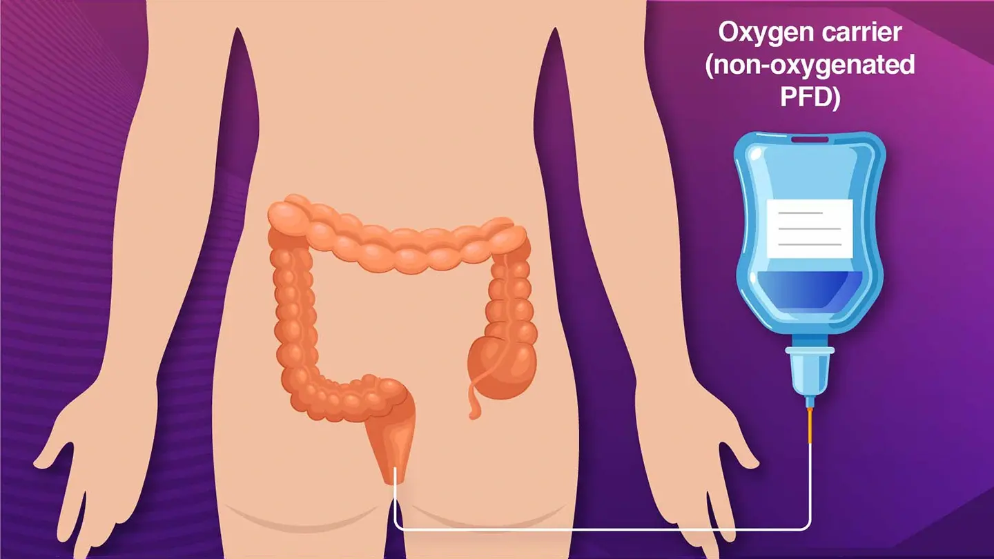 Delivering oxygen through the intestine: enteral ventilation shows promise in human trials